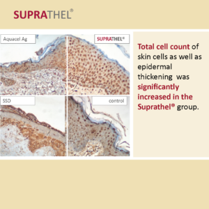 07.	The SUPRATHEL® Benefits