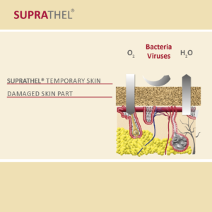 08.	Indication Deep Dives